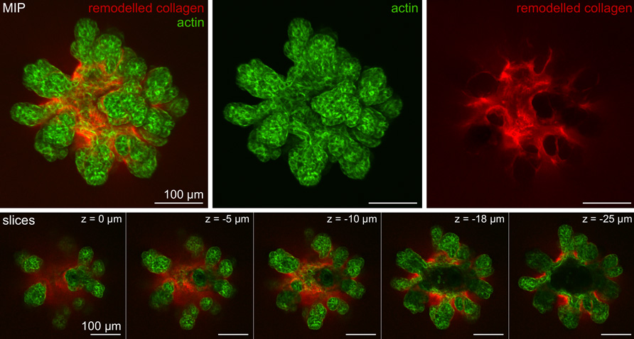 Extracellular matrix remodeling in organoid culture